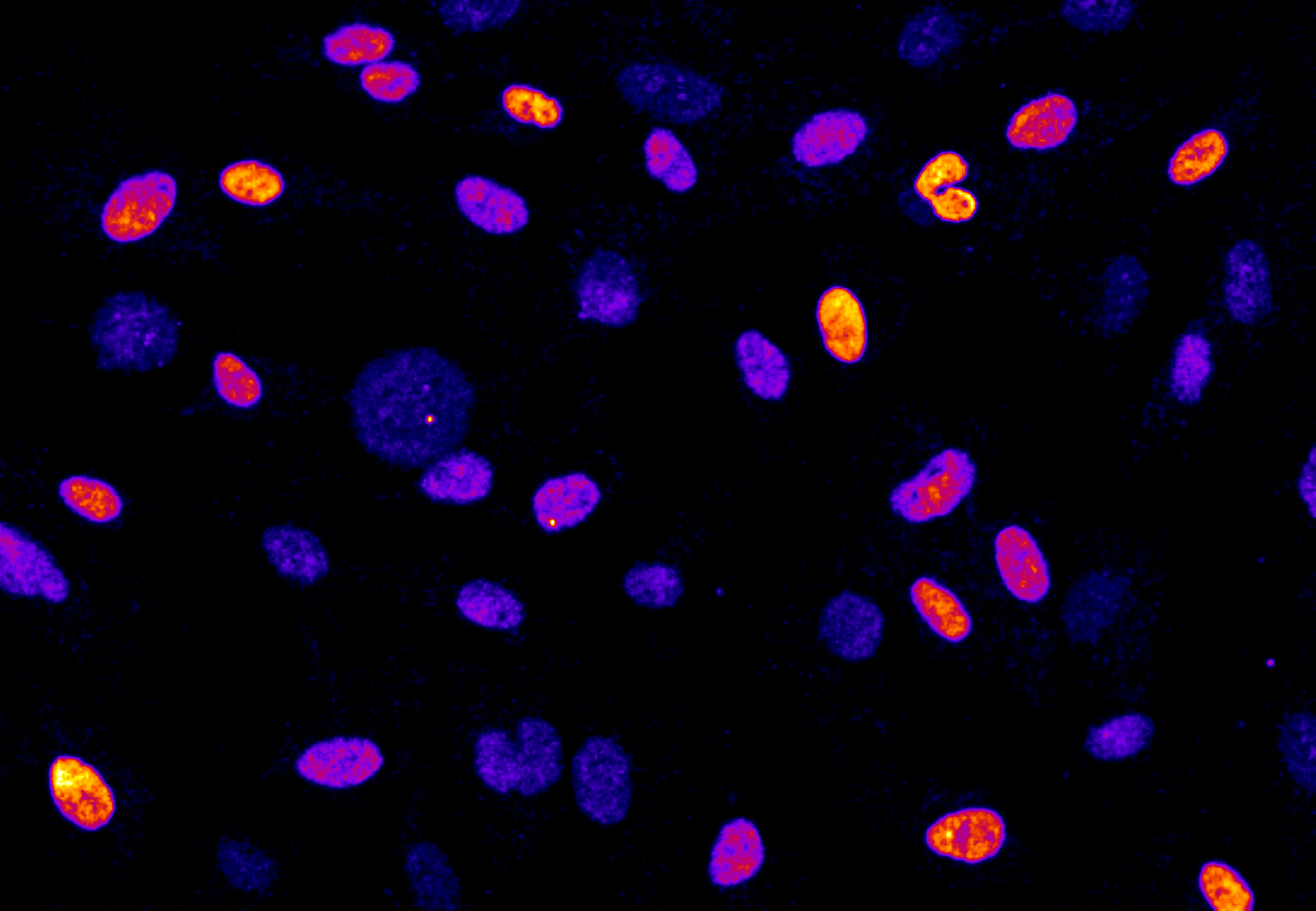 Cells That Activated The Tumor Suppressor P53 After Prolonged Mitosis Okinawa Institute Of 3073